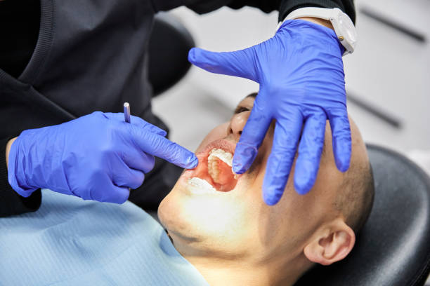 Best Weekend Emergency Dentist in Carrollwood, FL